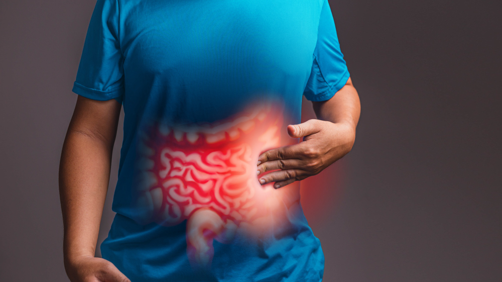 Dosagem de calprotectina fecal