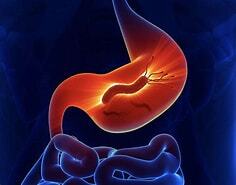 Teste Respiratório para pesquisa de H.pylori